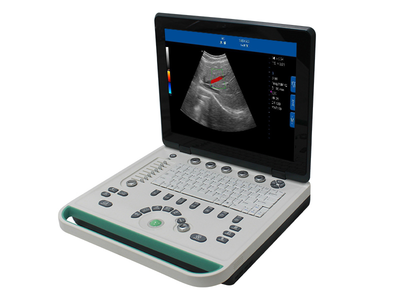 C5Pre Système de diagnostic par ultrasons Doppler couleur