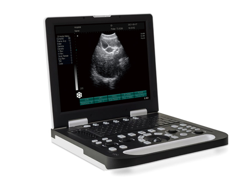 SS - 10 diagnostiqueur ultrasonique portable entièrement numérique