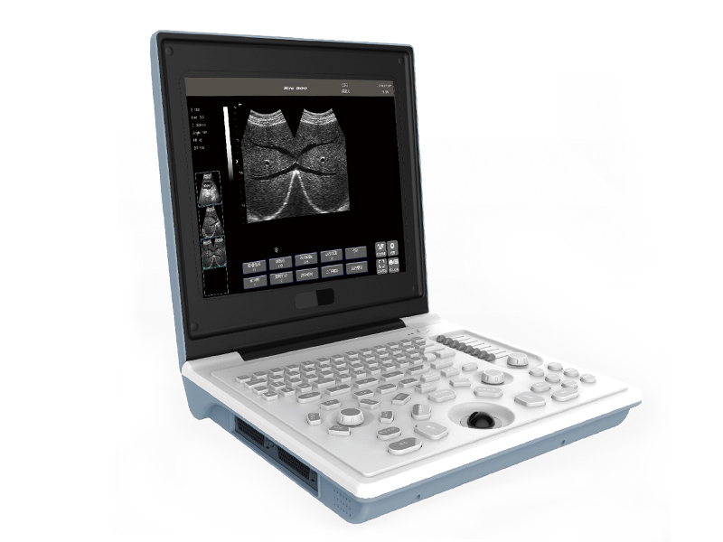 SS - 6B diagnostiqueur ultrasonique numérique complet pour ordinateur portable