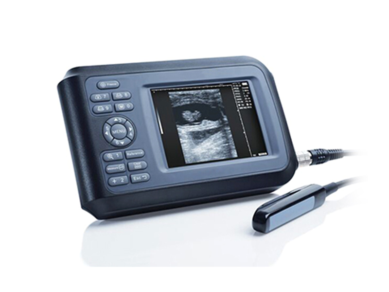 V7 Système de diagnostic à ultrasons entièrement numérique portable