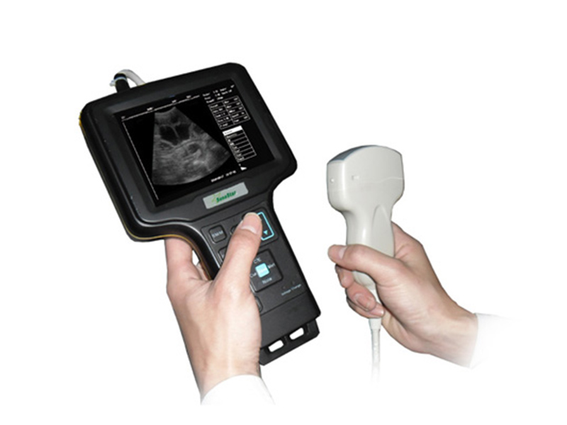 V6 Modèle  Palm Ultrasound Image diagnostic (b Ultrasound Diagnostic noir et blanc)