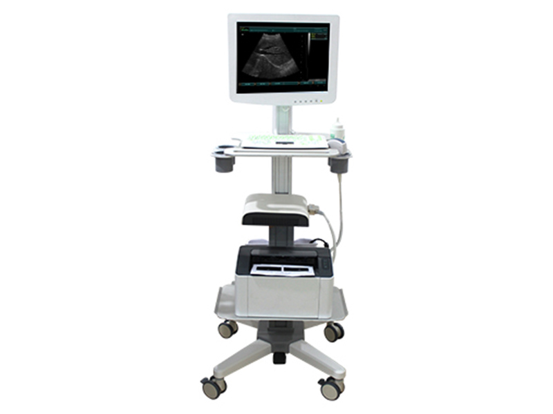 SS - 100 Modèle  diagnostiqueur d'affichage à ultrasons de chariot d'écran tactile (bsultr