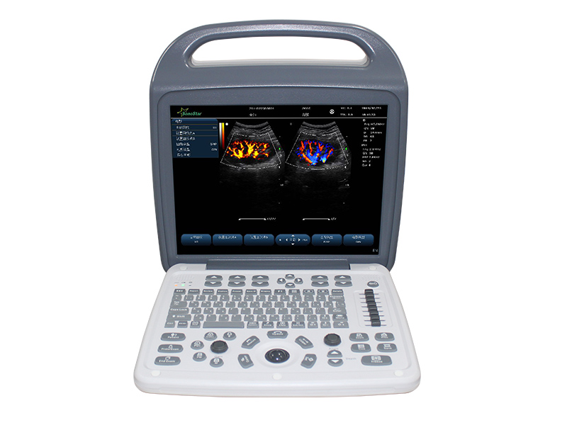 C10M portable Color ultra B Ultra Color ultra ultra ultra diagnostic instrument Doppler