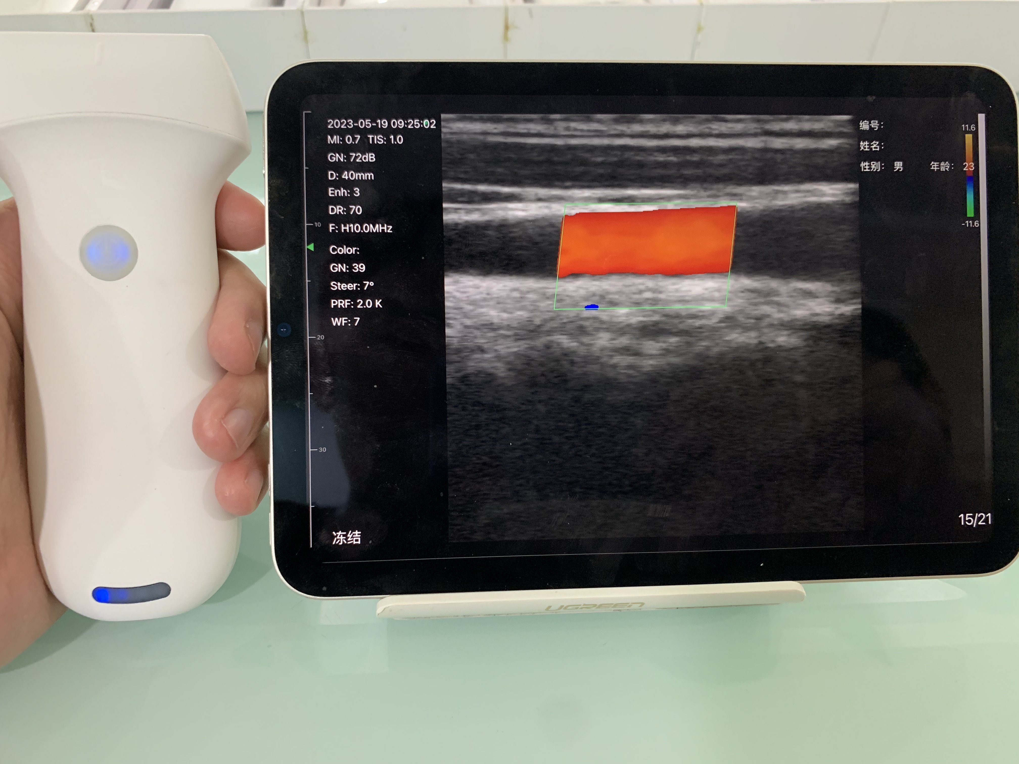 8L Linear Palm Doppler Ultrasound