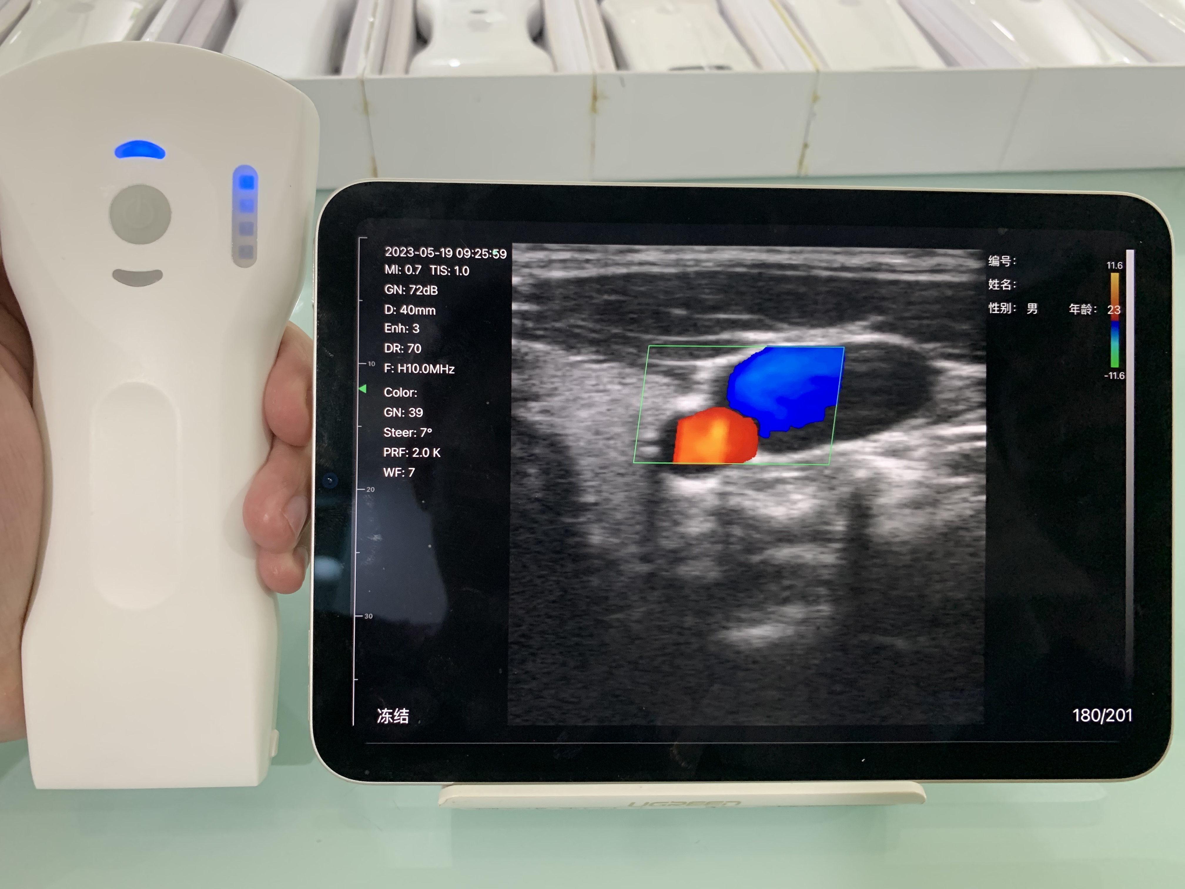 8CPL 3in1 Palm Doppler Ultrasound