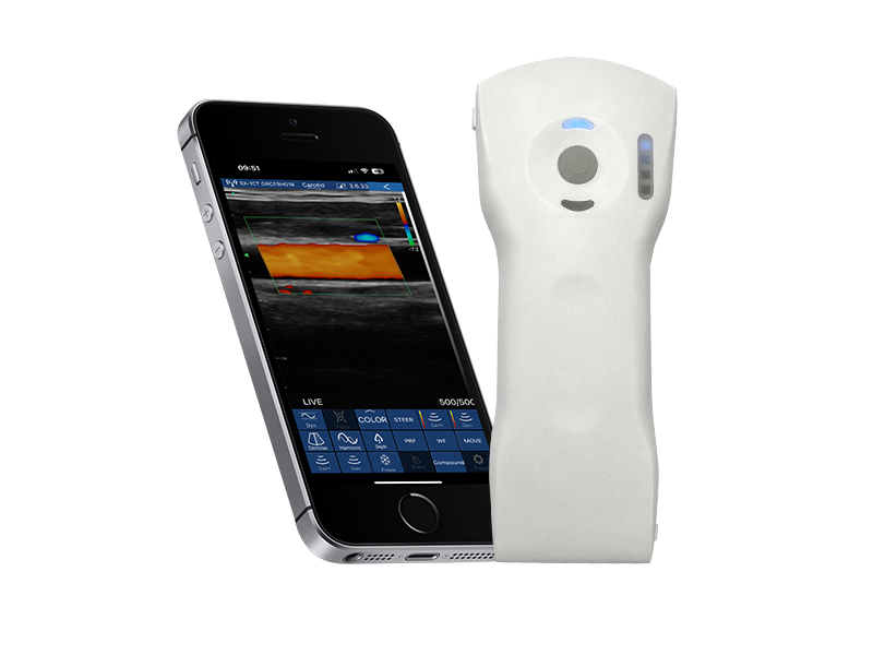 8CPL 高配三合一无线探头式掌上彩超