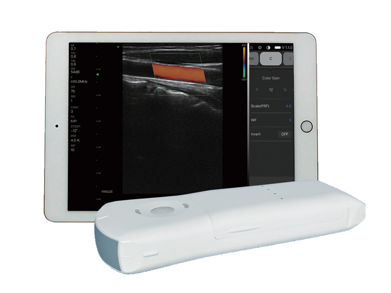 10CPL 3 en 1 Écographie Doppler de la paume