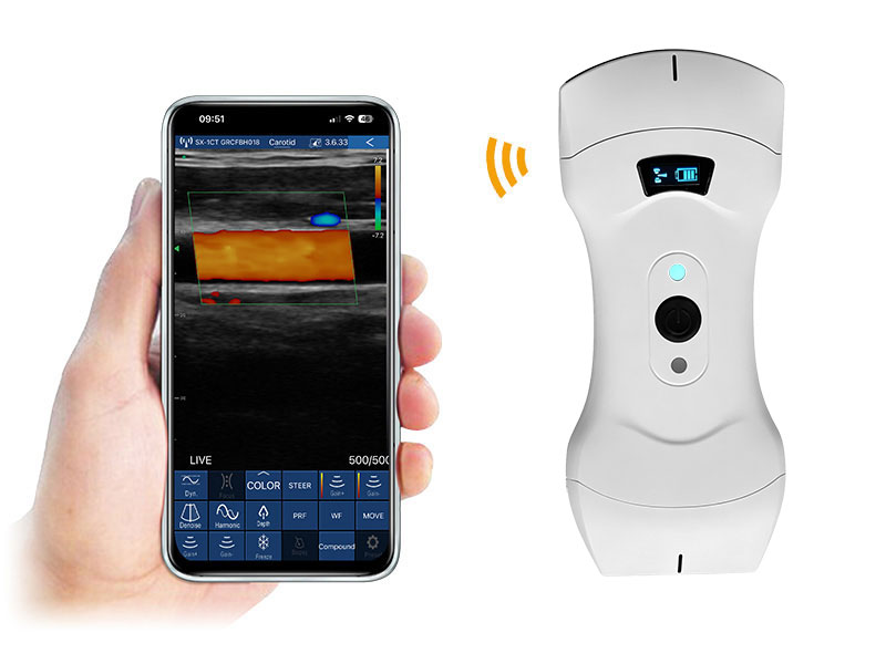 6CPL Plus scanner à ultrasons doppler palmier 3in1