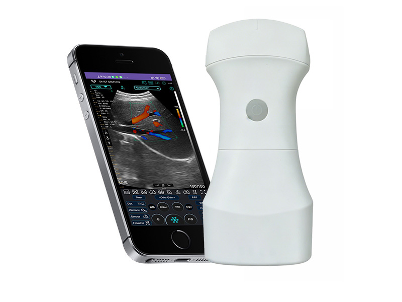 Ultrasons doppler de paume convexe de batterie remplaçable 9C