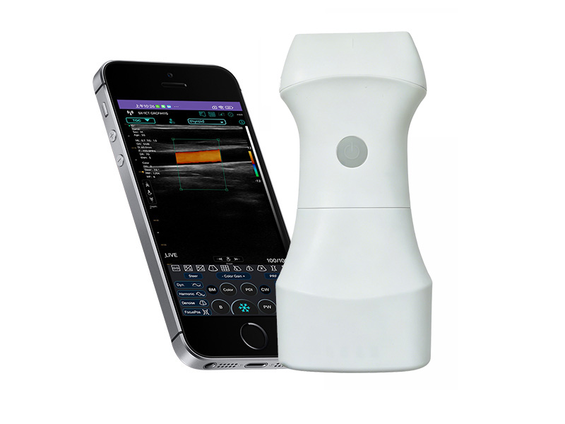 9L batterie remplaçable scanner à ultrasons linéaire de la paume doppler (VIP exclusif)