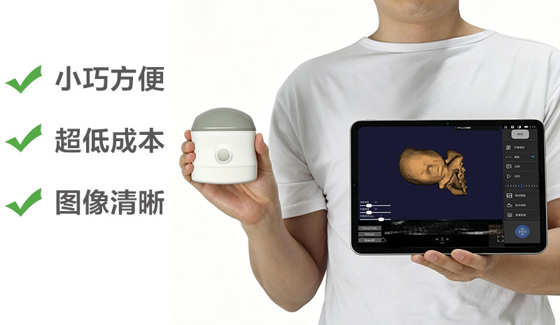凸阵 vs 线索诺星4D立体成像掌上超声：哪种适合你的科室